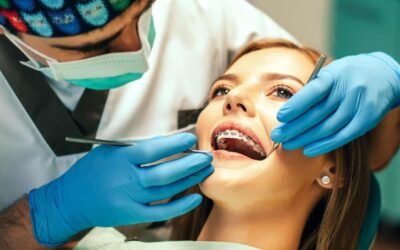 The Best Orthodontic Color Band Combinations for Braces